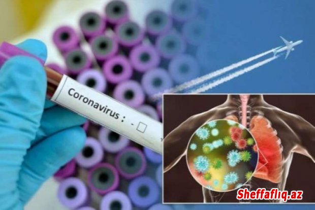 Çin koronavirusa qarşı effektiv dərman vasitəsi tapıb.