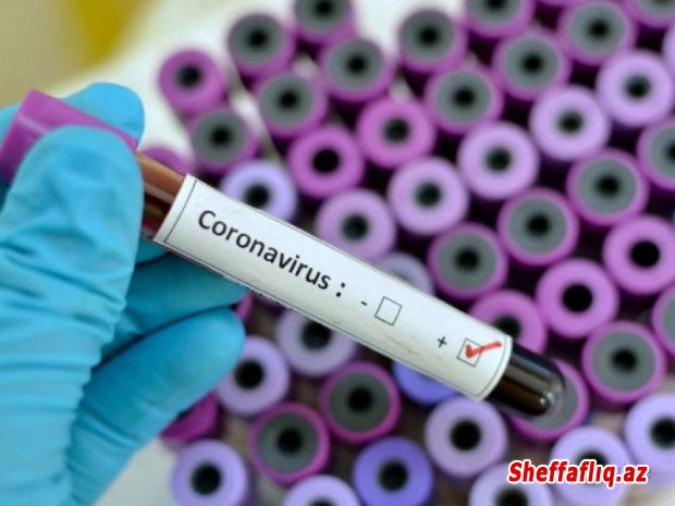 Azərbaycanda koronavirusa yoluxan 2-3 yaşlı uşaq da var - RƏSMİ