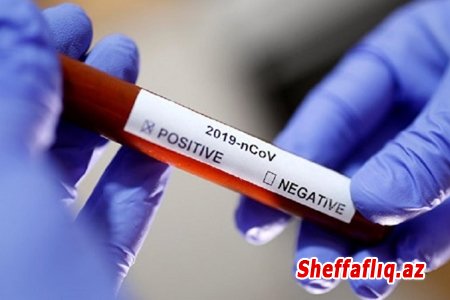 Belarusda 47 minə yaxın insan koronavirusa tutulub
