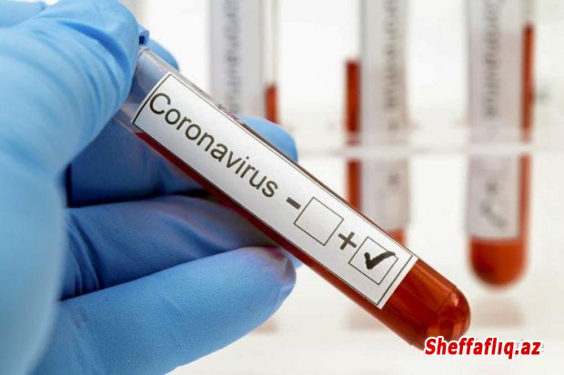 Almaniyada son sutkada 348 nəfər koronavirusa yoluxub - 18 nəfər ölüb