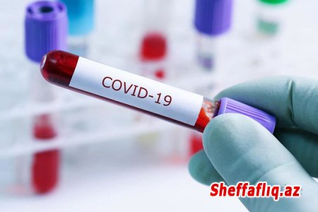 Daha 471 nəfər koronavirusa yoluxdu - 7 nəfər vəfat etdi