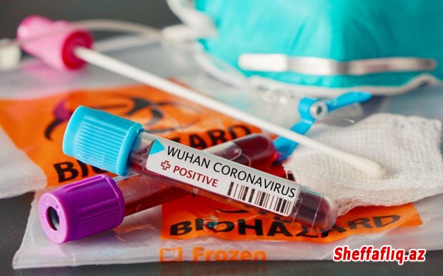 Dünyada koronavirusa yoluxanların sayı 15,1 milyonu ötdü