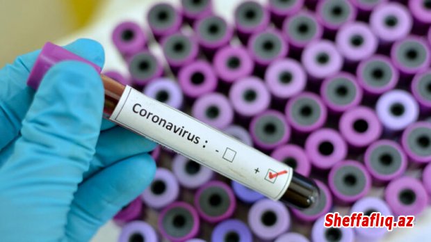 Azərbaycanda 135 nəfər koronavirusa yoluxdu, 2 nəfər öldü