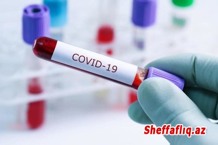 İranda ötən sutkada 116 nəfər koronavirusdan ölüb