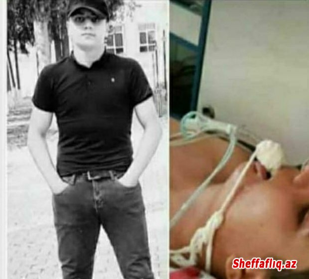 Ağsu rayonunda 5 gün öncə döyülən 14 yaşlı Nihad Məmişov xəstəxanada vəfat edib.