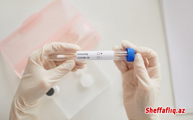 Gürcüstanda koronavirusa 1 364 yeni yoluxma qeydə alınıb - 22 nəfər ölüb