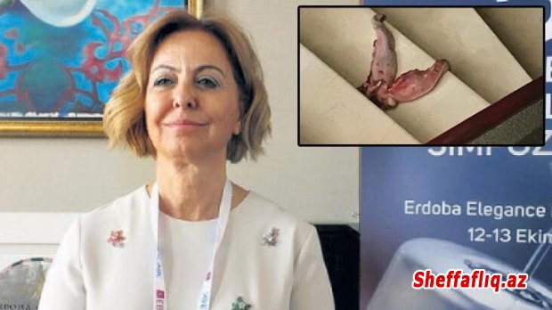 Prof. Dr. Şenolun dana dili ilə ölüm təhdidi