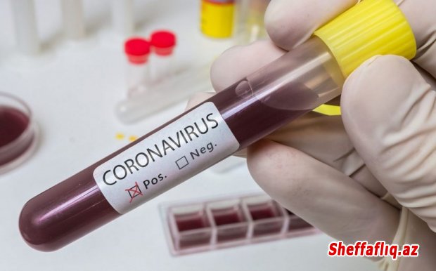 Azərbaycanda daha 48 nəfər koronavirusa yoluxub, 3 nəfər vəfat edib
